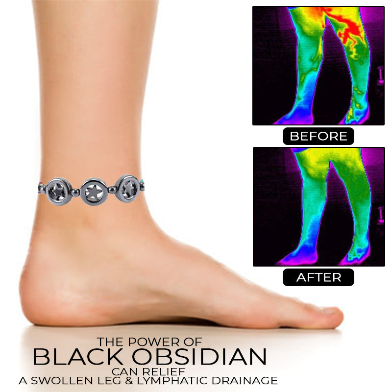 Anti Swelling Obsidian Magnetic Therapy Anklet